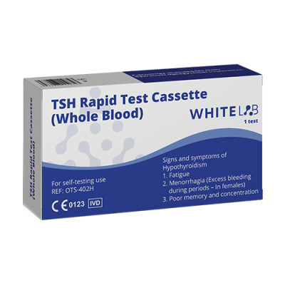 Brzi test za štitnjaču – razina TSH